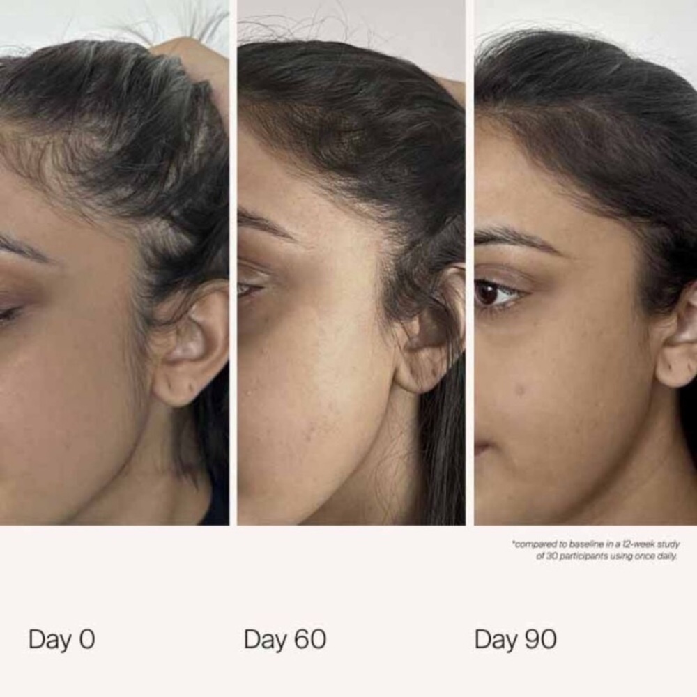 Living Proof Scalp Care Density Serum 1.7oz - Picture 2 of 5